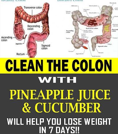Pineapple Juice And Cucumber To Clean The Colon in 7 Days And Help You Lose Weight