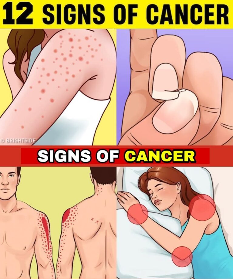 12 Early Warning Signs Your Body May Be Developing Cancer Cells