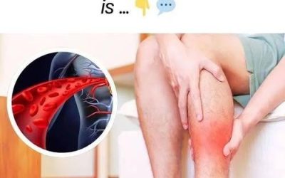 One vitamin that opens blood vessels and improves circulation