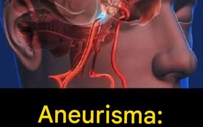 Aneurysm: signs you shouldn’t ignore…