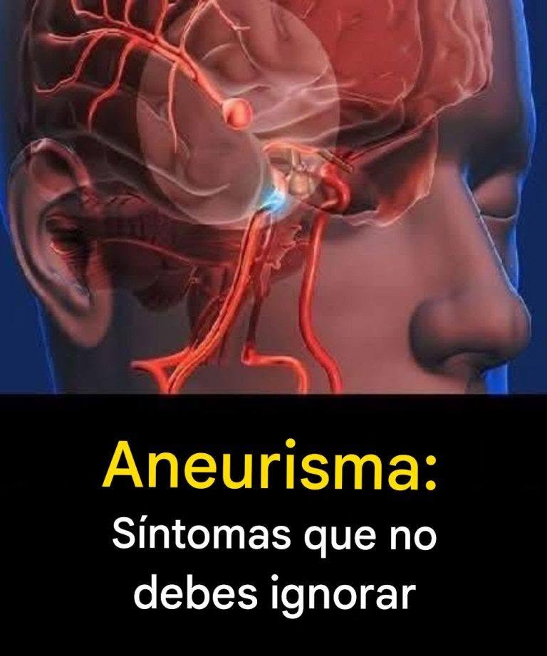 Aneurysm: signs you shouldn’t ignore…