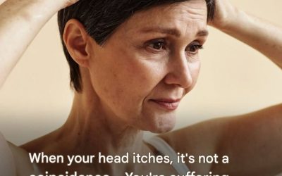Itchy scalp: what are the possible causes? Answers from a dermatologist
