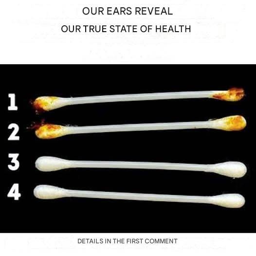 Our ears reveal the true state of our health